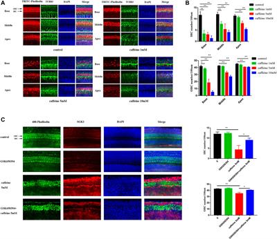 Caffeine Induces Autophagy and Apoptosis in Auditory Hair Cells via the SGK1/HIF-1α Pathway